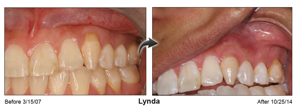 Before and Afte picture